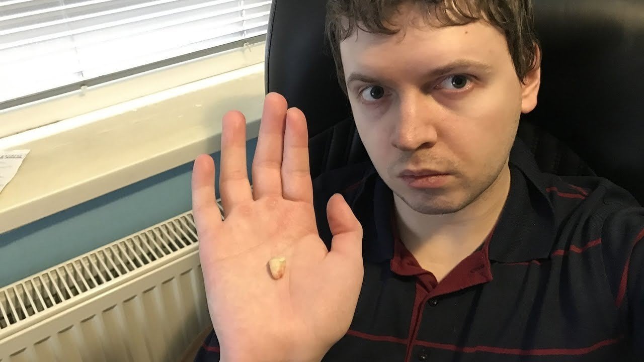 Фанаты продолжают донимать Папича  один из них засунул батончики Nuts в его щиток
