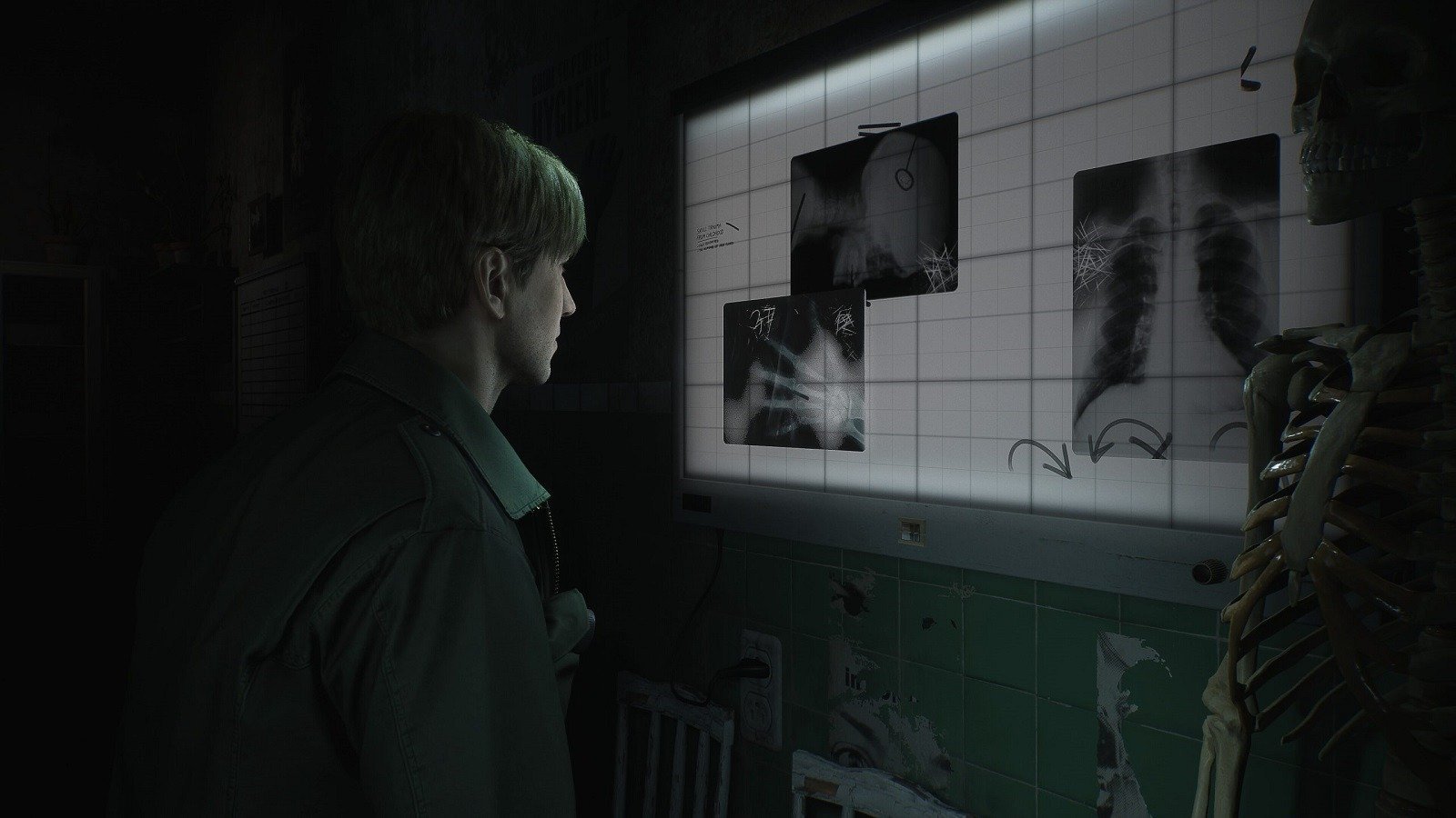 Новый геймплей ремейка Silent Hill 2 покажут на этой неделе