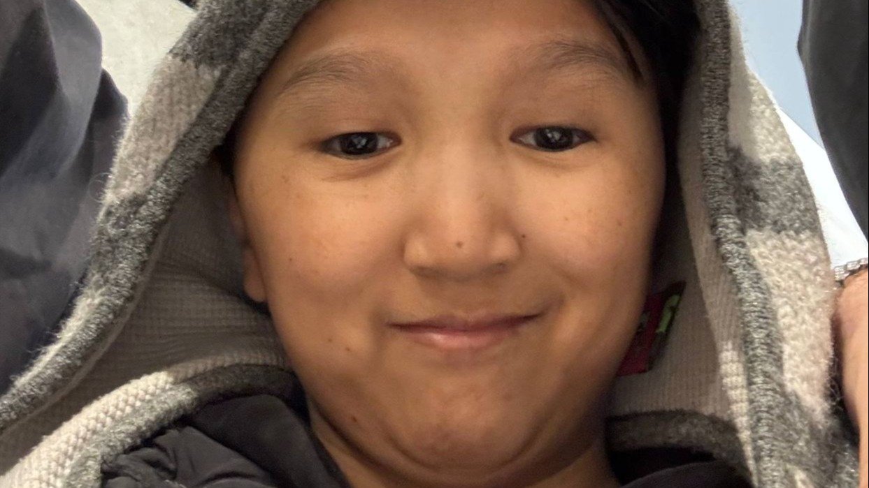 У Элдоса обнаружили рак  комику назначили дорогостоящее лечение