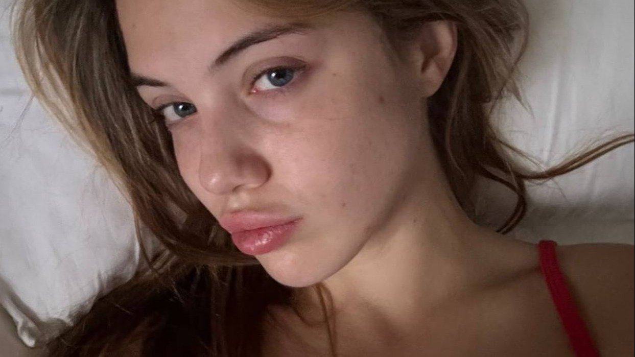 Акулич наконец поставили диагноз  болезнь не лечится